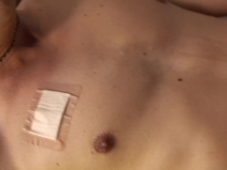 Gay nurse treats his straight patient with hard cock