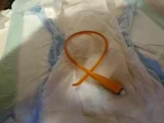 Removal catheter