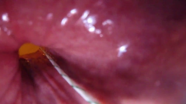 Internal camera porn - Internal view of my asshole getting stretched