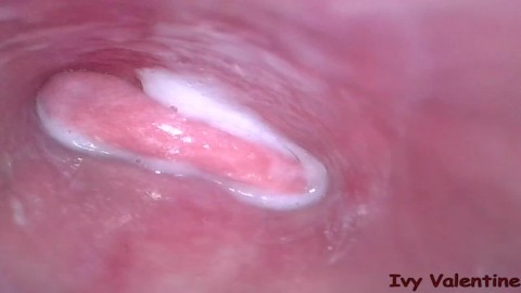 Der vagina in kamera Vulvovaginal Health