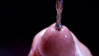 a péniszbe injektált szintol