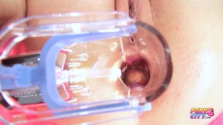 Anal Speculum Exam and Fucking